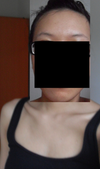 Camera lighting is difficult, but this is the best illustration of color of face vs. rest of body.