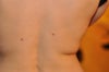 back