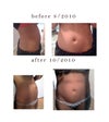 after front ( six weeks
