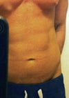Droopy Belly Button