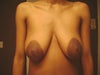 saggy 32DD