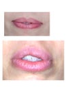 before and 2wks after