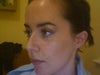 This is my nose at present.