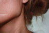 this is how my scar looks