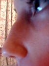 My nose, November 2010