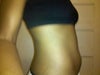 Right side angle