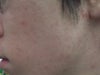 you can clear see the brown blotches everywhere. sorry for the bad quality!