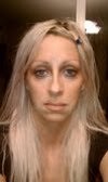 31 years old. I have extremely hollow flat cheeks
