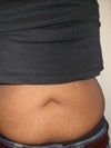 My tummy now