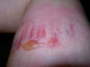 24 hours after injection