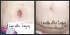 Belly button. 