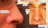 My current nose.