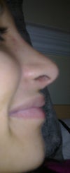 Lump 