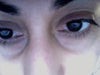 Eyes