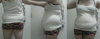Love handles bother me the most.