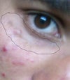 the one marked in the circle..it may look normal but its so clear when i remove my glasses.