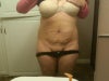 Tummy Tuck, San Fran Bay Area Doctors