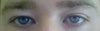 my eyes