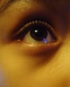 It's really dark, and you can see hollow eyes. When I smile, it just seems as if my eyes are swelling because of the bags.