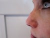 nose bulge
