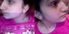 right & left side.