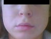 as you can see very full around jaw, very flat on cheekbones