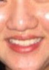 Nose