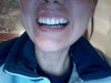 Current teeth