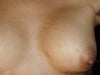 This is the hole formed when I contract my breast.