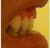 Note: gums