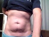 frontal stomach area