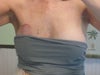 This was also taken on 1-12-11.  My blood work CA27.29 showed 12.6 (anythin below 38 was normal.