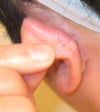 Top Left Ear