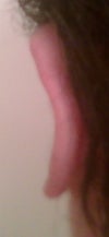 Left Ear Back View