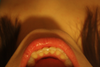 Bottom teeth from above.