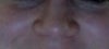 nose tip smiling