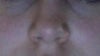nose tip not smiling