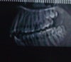a picture of CT scan .