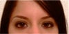 assymetrical eyes/eyelids