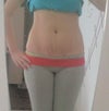 Do I need a tummy tuck?