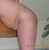 Jan 23rd before surgery side bending position