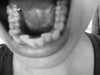 Bottom