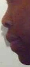 side - round nose with wide nostrils