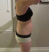 side 6 weeks post op