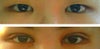 Comparison
