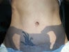 This is my scar.... HELP!