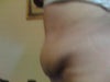 Left side view - 4 weeks post op