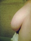 Right Breast