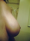 Left Breast