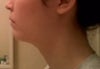 I have a slight overbite that I am going to correct. Will it be better to try to bring my lower jaw forward or push my upper teeth back?